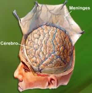 foto-meningite-1