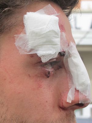 Homofobia na Paulista