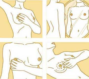 cancer de seio toque