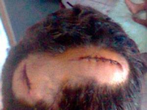 agressao homossexual