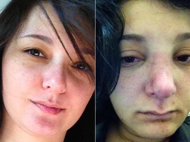 adrianatamashiroagressao