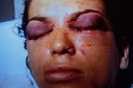 Homem que furou olhos da ex-mulher vai a júri popular em Goiânia