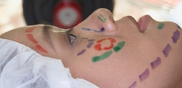 Machismo, saúde da mulher e cirurgias plásticas: o que as panelas têm a ver com isso?