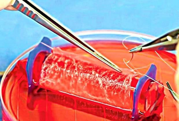 Quatro mulheres recebem vagina criada em laboratório