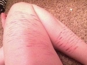 A dor de ter uma filha que se corta