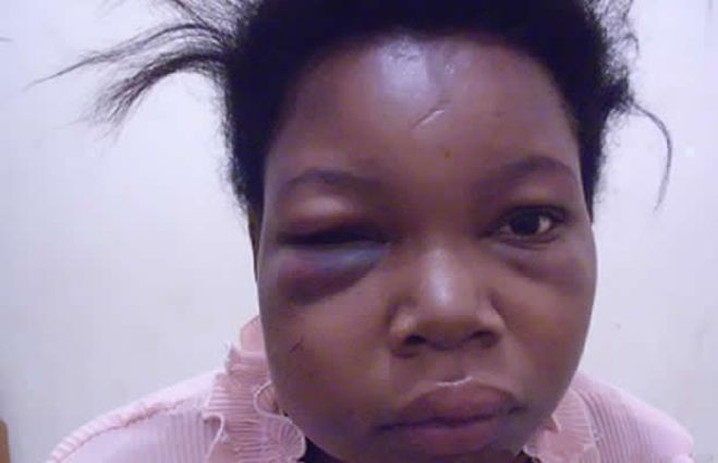 violencia contra mulher